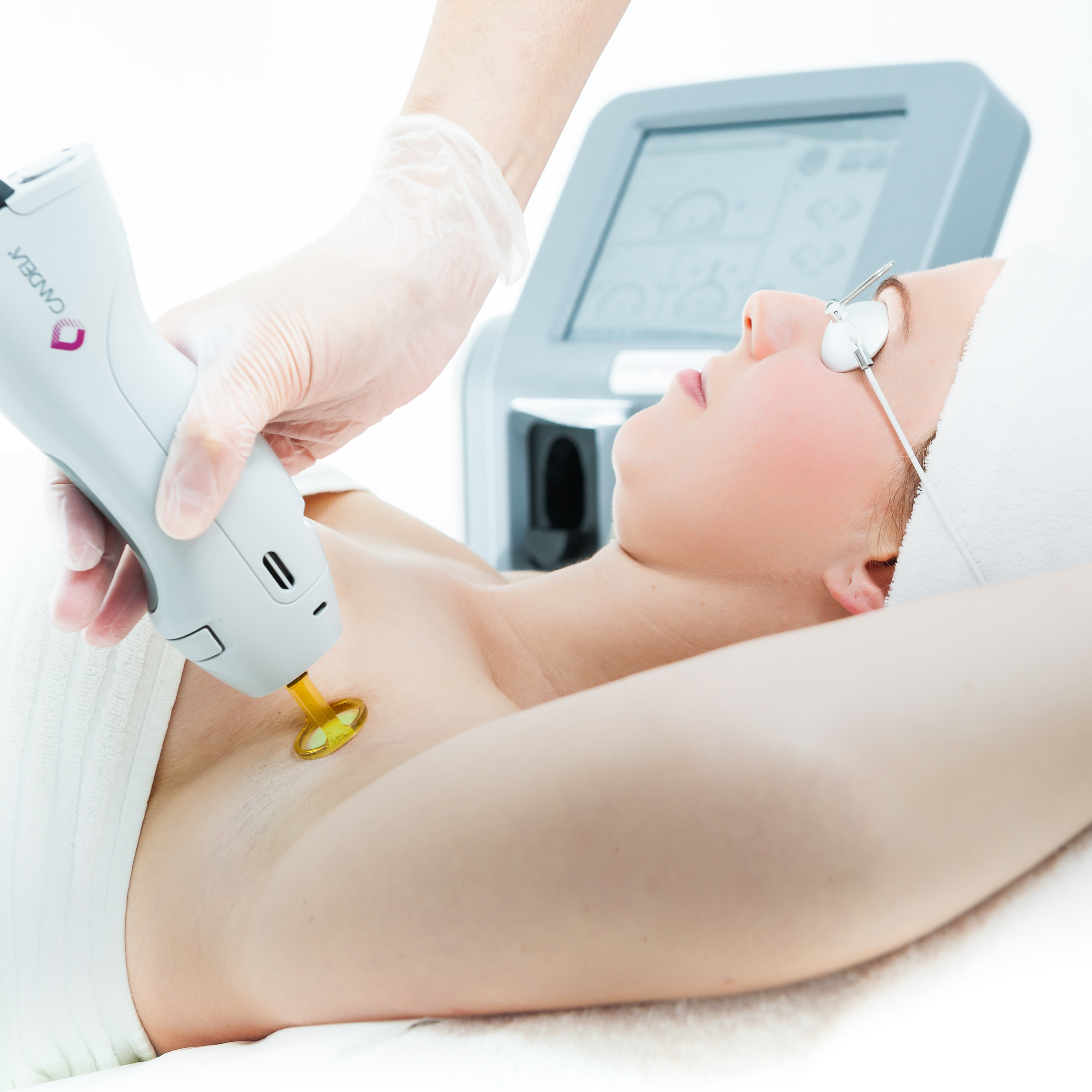 Laser Hair Removal - SpaTru Face and Body Lounge, Langley Kamloops